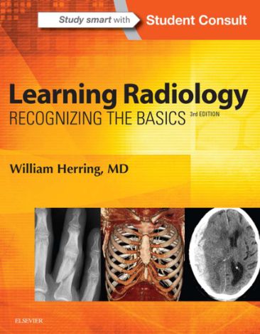 Learning Radiology: Recognizing the Basics cover