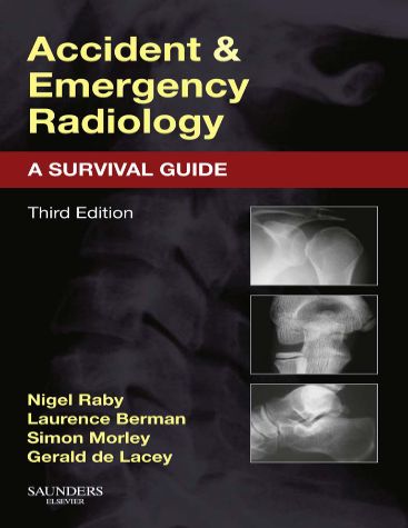 Accident & Emergency Radiology: A Survival cover