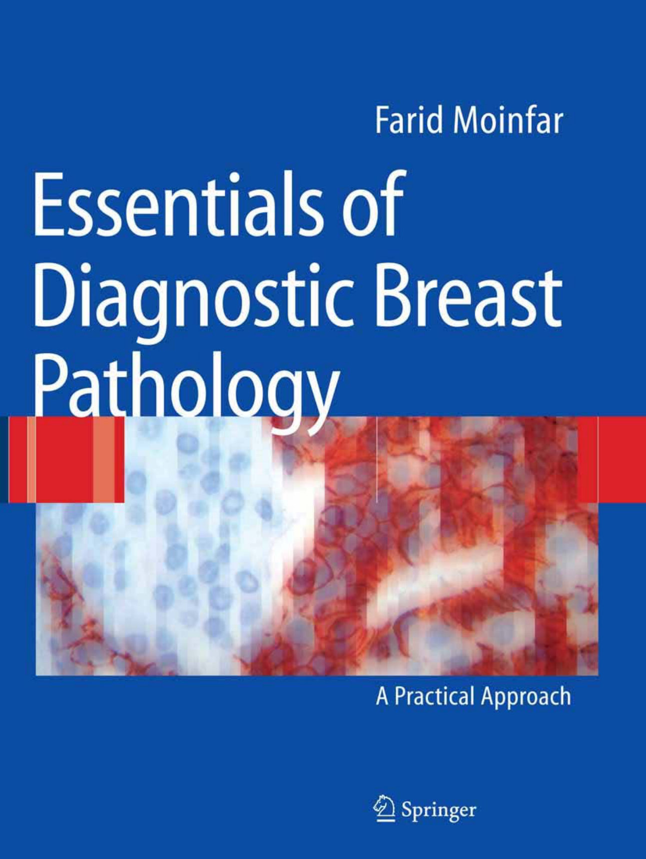 Essentials of Diagnostic Breast Pathology cover